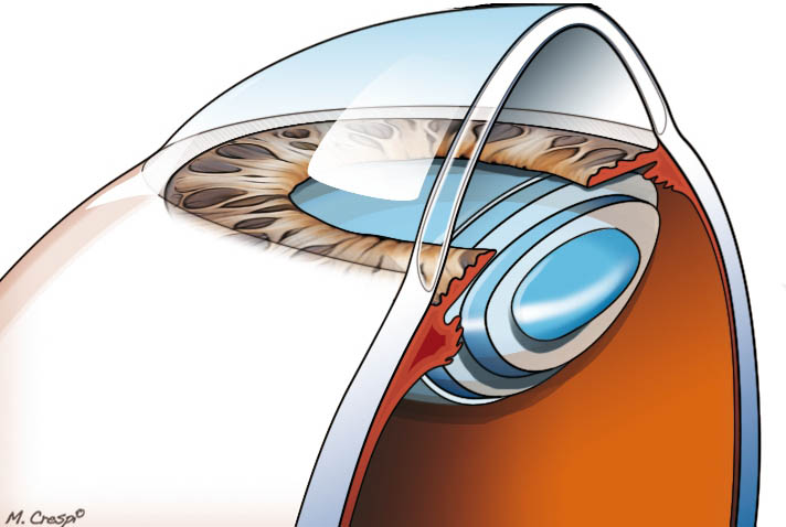 disegno a colori di una sezione della cornea umana