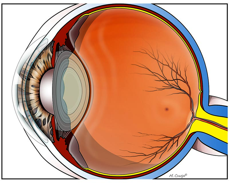 immagine di un occhio in cui è presente La retina sana