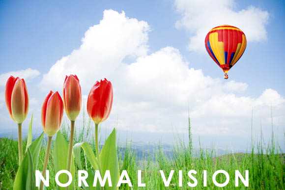 Normal vision
