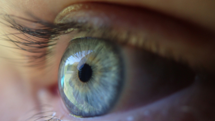 lenti-intraoculari lenti intraoculari - CAMO - Centro Ambrosiano Oftalmico